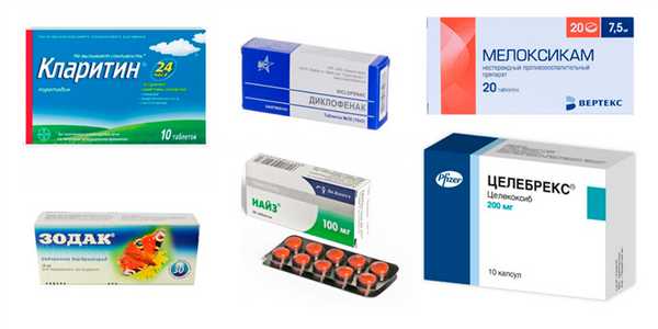 Обострение псориатического артрита