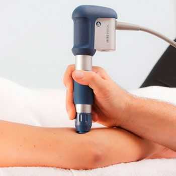 ударно волновая терапия суставов локтя