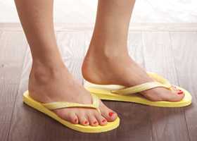 Эпидермофития стоп и паховая эпидермофития