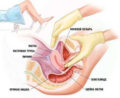 Гинекологический осмотр