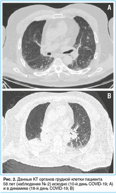 Таблица 1. Данные электронейромиографии