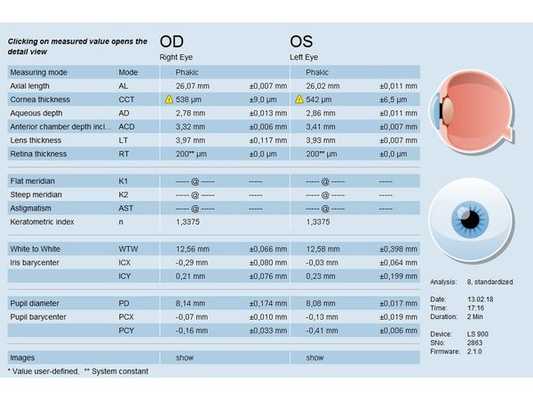 Результаты оптической биометрии на аппарате Lenstar. Роговица в центре настолько плоская, что биометр не может определить её кривизну.