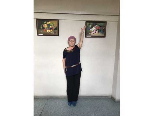 Функциональный результат через 3 года после травмы