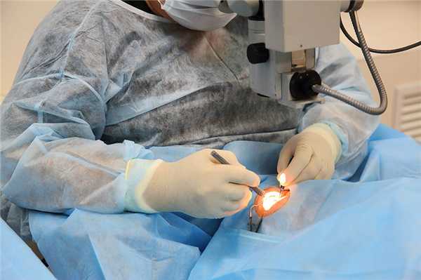  Удаление катаракты, лечение катаракты