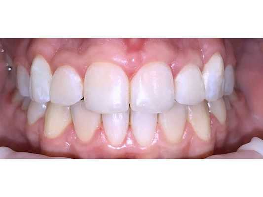 После лечения