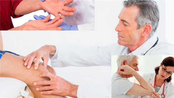 Лечение серопозитивного артрита