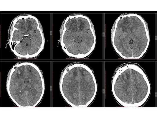 Послеоперационные аксиальные КТ-сканы