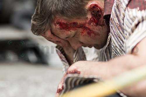 Травма наружного уха - частая патология