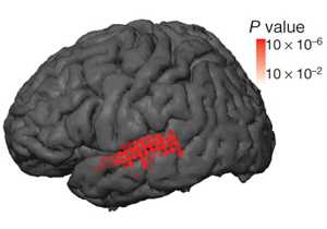 Расположение электродов на мозге испытуемых