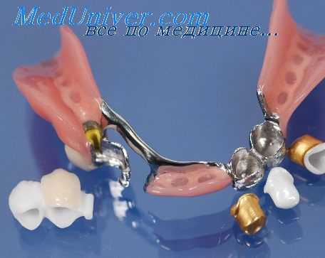 аллергия к зубному протезу