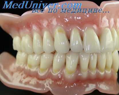 аллергический стоматит