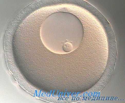 гибель ооцита