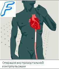 Внезапная коронарная смерть (первичная остановка сердца). Факторы риска внезапной коронарной смерти.