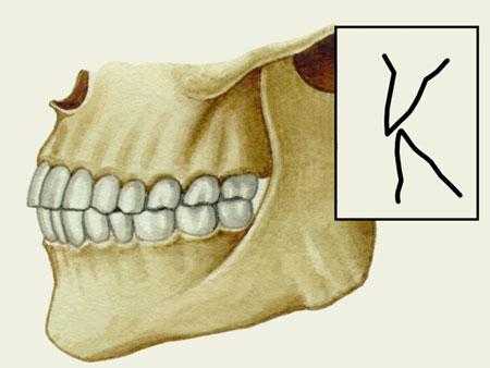 Ортогнатический прикус. Вид сбоку
