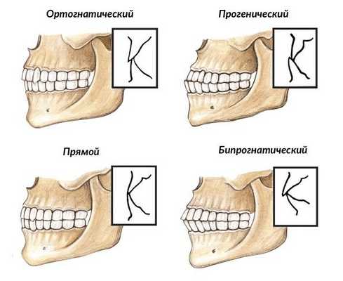 Виды физиологического прикуса