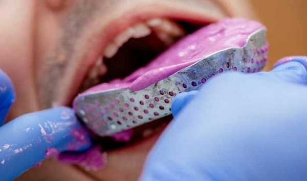 Искусство получения оттисков