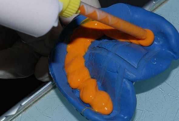 Плюсы и минусы цифровой и традиционной техники получения слепков