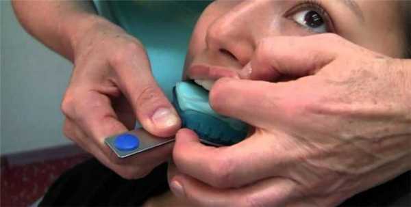 Слепок зубов