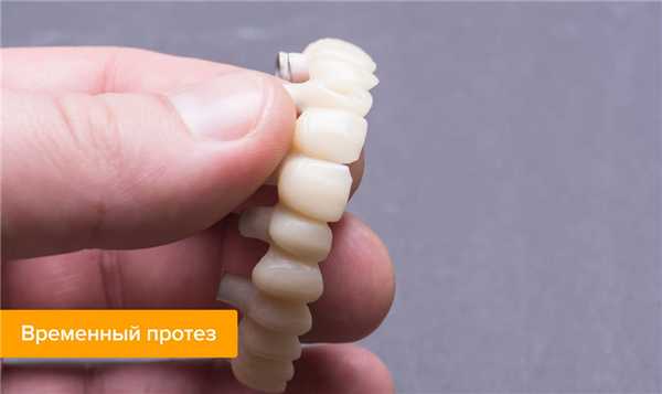 Фото временного протеза