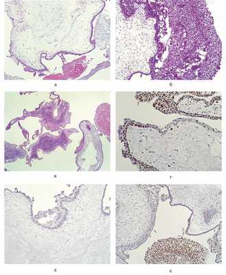 Гриценко (Макарова) Татьяна Александровна, репродуктолог, акушер, гинеколог - Москва