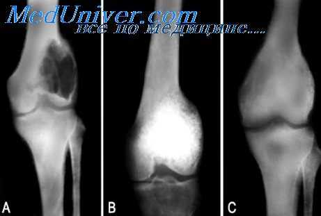 тяжесть черепно-мозговых травм