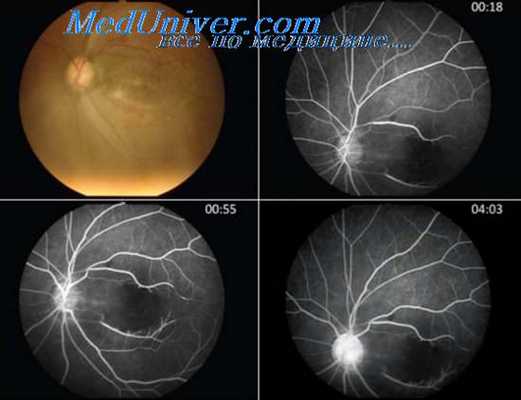 сочетанное действие токсинов