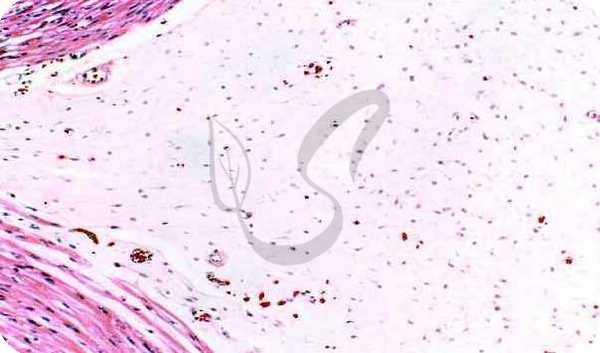 Слизистая ткань