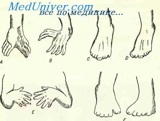 патология развития эмбриона