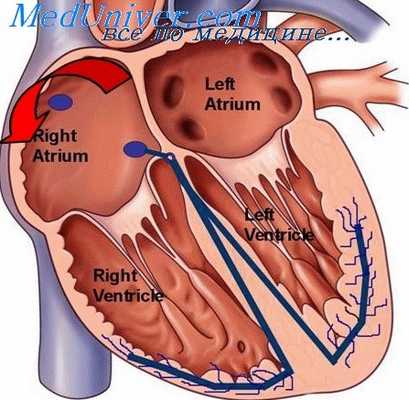 релаксация миокарда