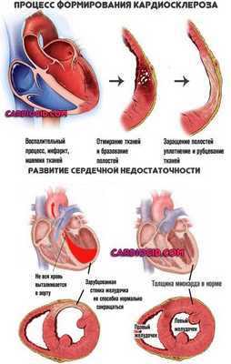 причина-хсн