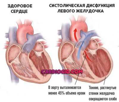 маленькая-фракция-выброса
