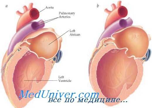 сократимость миокарда