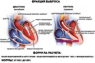 фракция-выброса