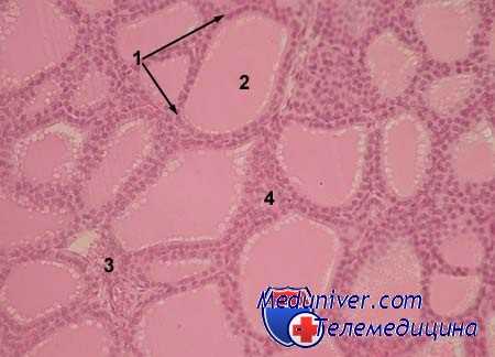 рак щитовидной железы