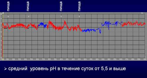 рН-грамма тела желудка, анацидность желудочного сока