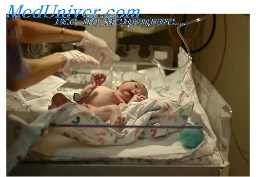 фето-фетальная трансфузия у ребенка