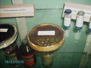 Особенности культивирования анаэробных бактерий