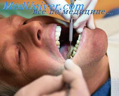 асептика полости рта