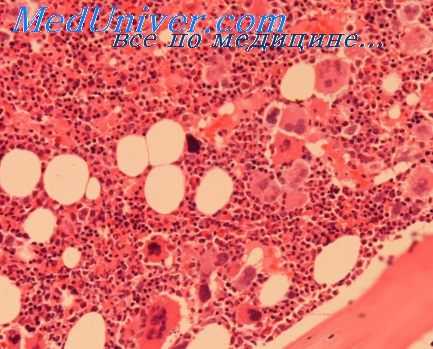 морфология сердца