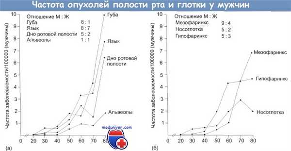 Опухоли полости рта и глотки