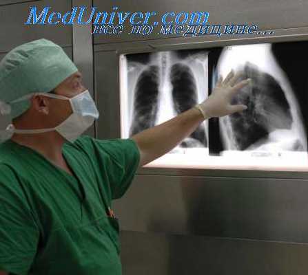 лечение туберкулеза