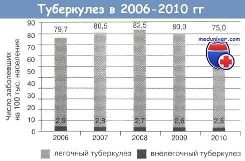 Распространенность туберкулеза