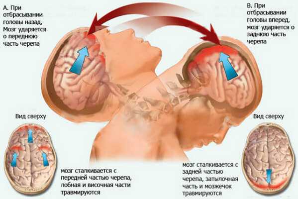 первая помощь при травмах