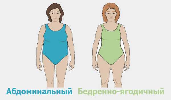 тип ожирения