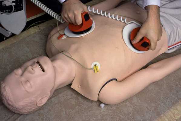 При проведении дефибрилляции электроды не должны касаться рук медперсонала