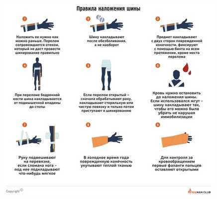 Правила наложения шины при переломе