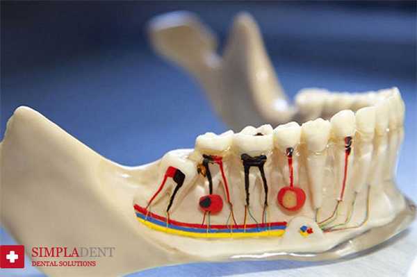Современные методы лечения зубных каналов