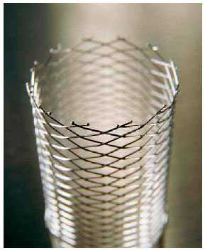 Стентирование уретры