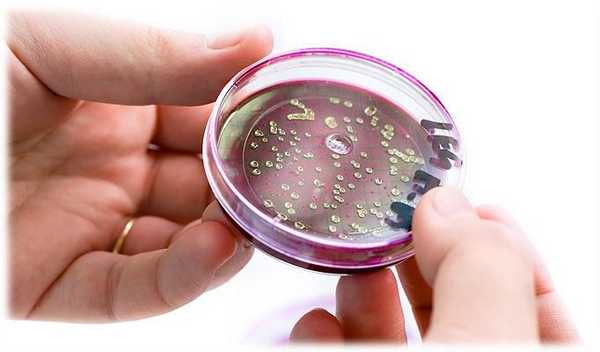 общие сведения о дисбактериозе и его лечении