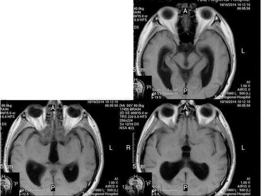 МРТ от 16.10.2014